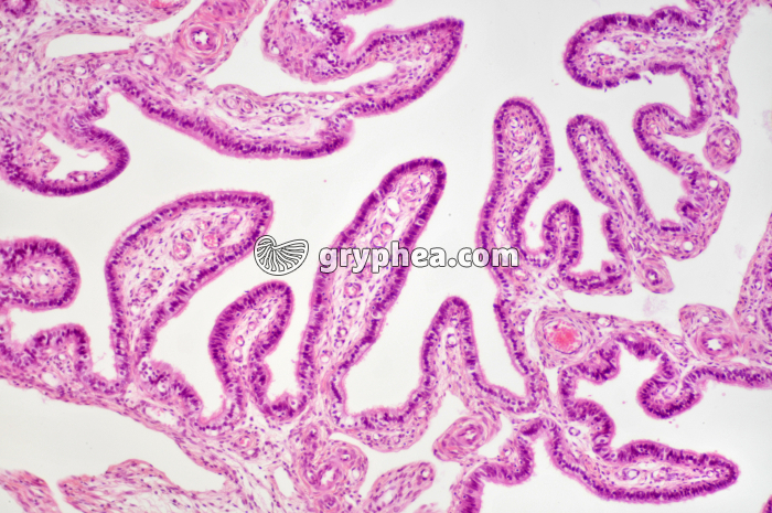 Trompe de Fallope x40 - gryphea.com